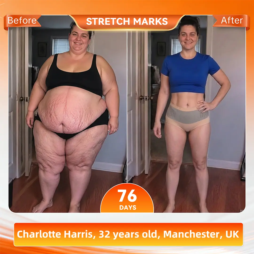 | 𝐎𝐟𝐟𝐢𝐜𝐢𝐚𝐥 𝐁𝐫𝐚𝐧𝐝 𝐒𝐭𝐨𝐫𝐞 🇬🇧| 𝐀𝐤𝐲𝐠𝐨® 𝟐𝟎𝟐𝟔 𝐌𝐨𝐫𝐢𝐧𝐠𝐚 x 𝐁𝐞𝐫𝐛𝐞𝐫𝐢𝐧𝐞 x 𝐍𝐀𝐃+ 𝟔-𝐈𝐧-𝟏 𝐌𝐢𝐜𝐫𝐨-𝐏𝐚𝐫𝐭𝐢𝐜𝐥𝐞 𝐒𝐜𝐮𝐥𝐩𝐭𝐢𝐧𝐠 & 𝐅𝐚𝐭-𝐁𝐮𝐫𝐧 𝐒𝐡𝐨𝐫𝐭𝐬 (Women + Men with Enhanced Male Vitality Blend)